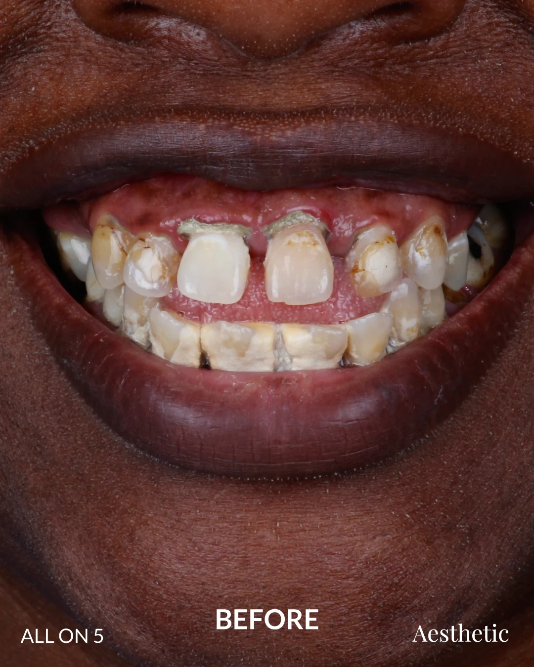 kenia-before